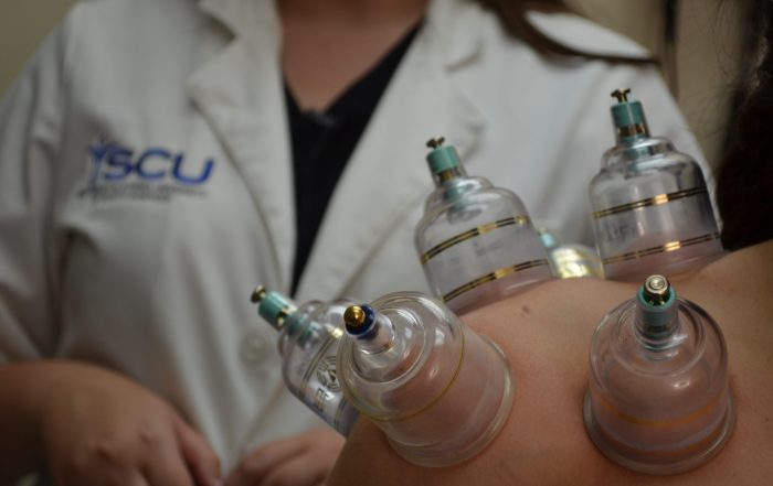 Dr. Jamie Kuljis performs a cupping treatment on a patient.